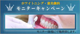 ホワイトニングモニター・審美歯科モニター キャンペーン 名古屋