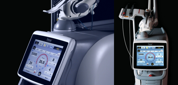 虫歯治療 レーザー 名古屋