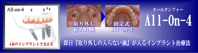 �I�[���I���t�H�[�@���É�